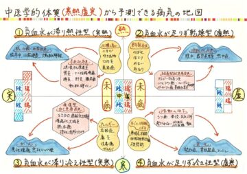 中医学の体質から将来かかる病気が予測できる！！